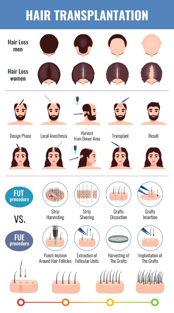 Hair Transplant Types