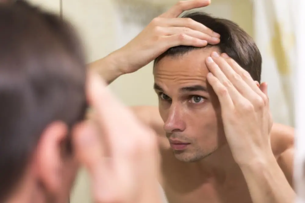 Male Pattern Hair Loss: Causes, Stages and Solutions