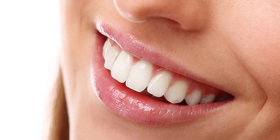 teeth whitening in istanbul